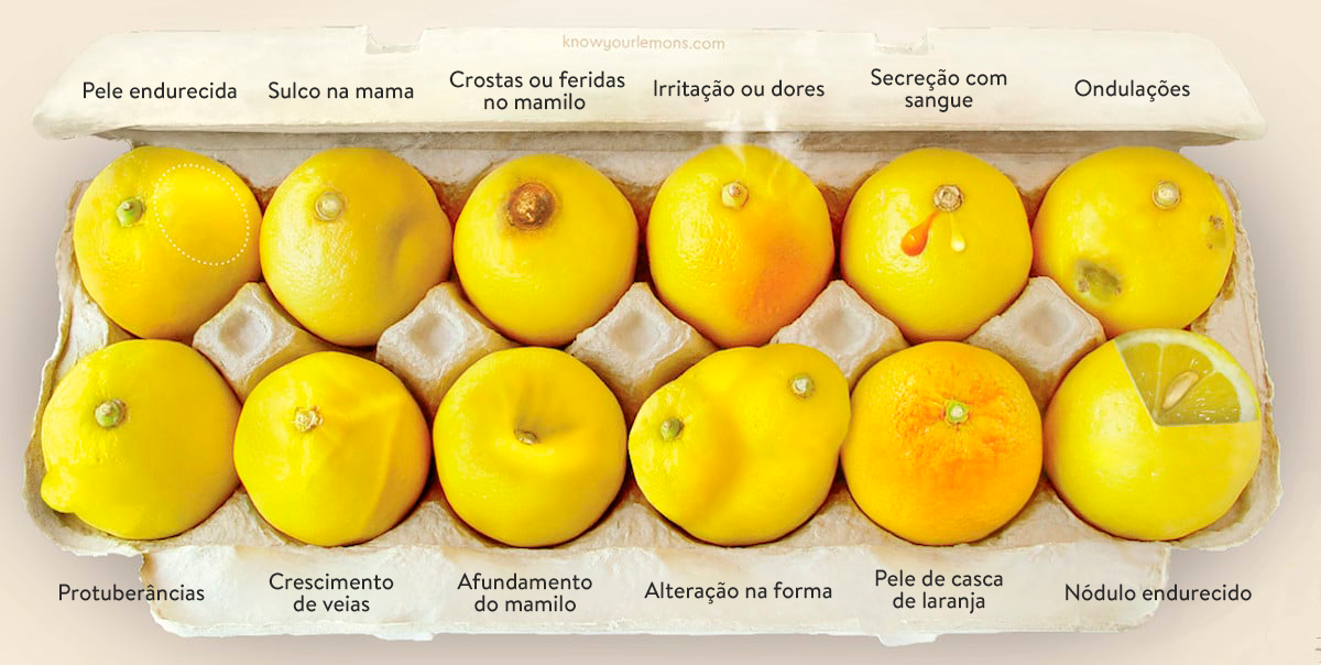 cancer de mama campanha know your lemons
